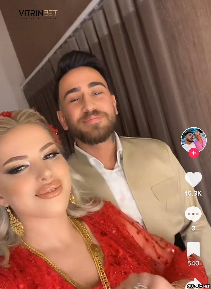 Ablamın dudağına ne olmuş...