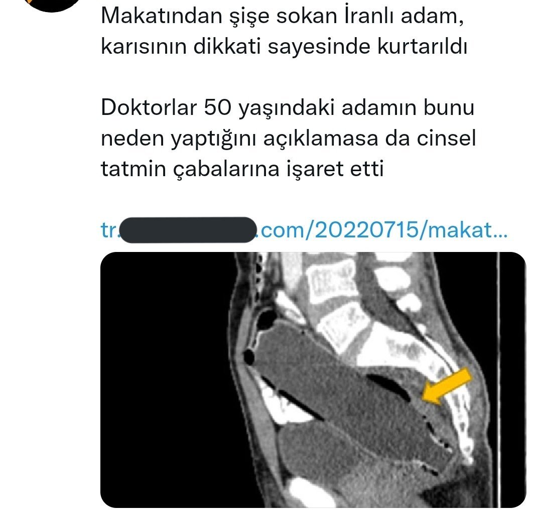şişeyi sokmuş.. tamamını.....