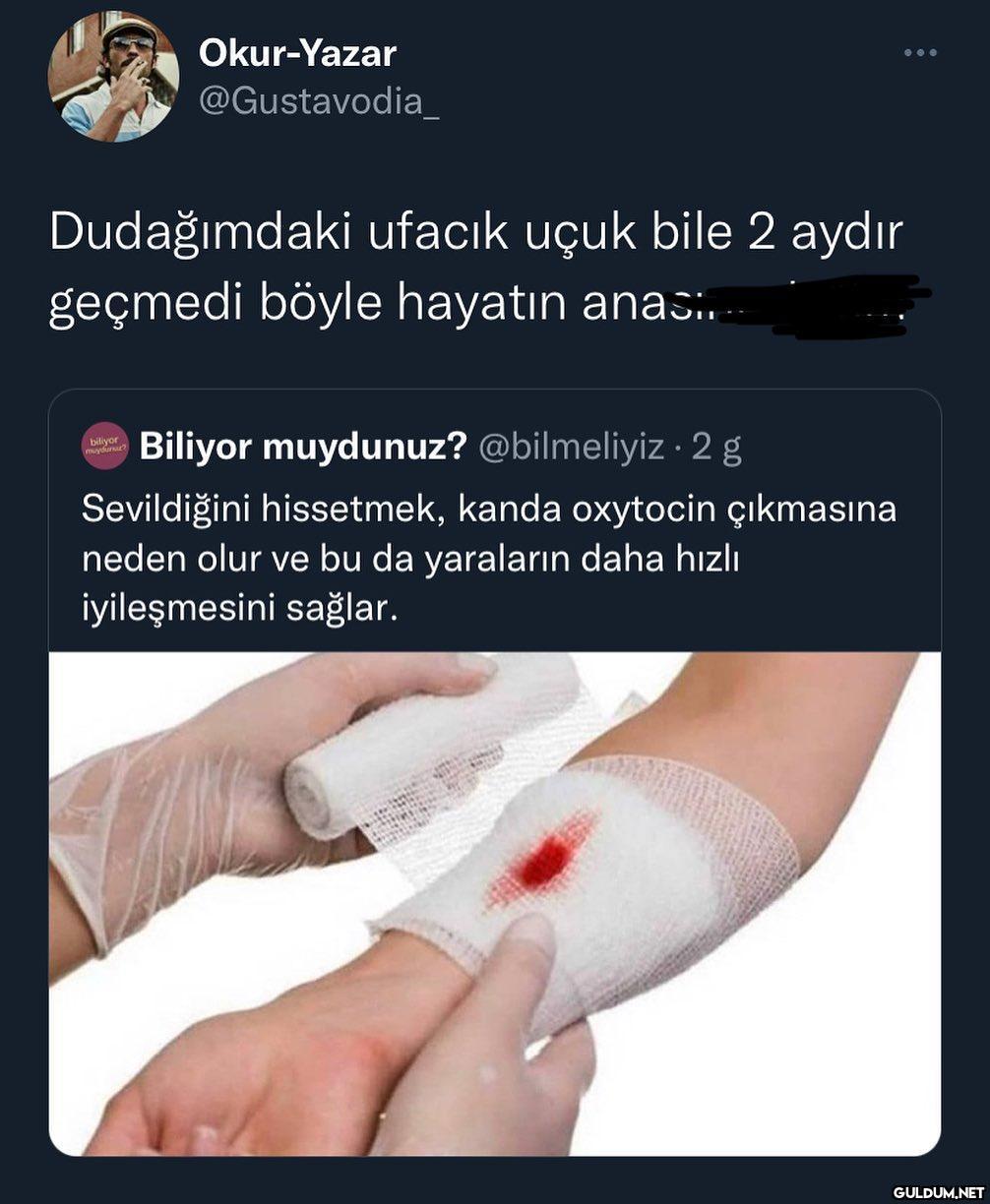 sevilmiyoruz napalım..   ...