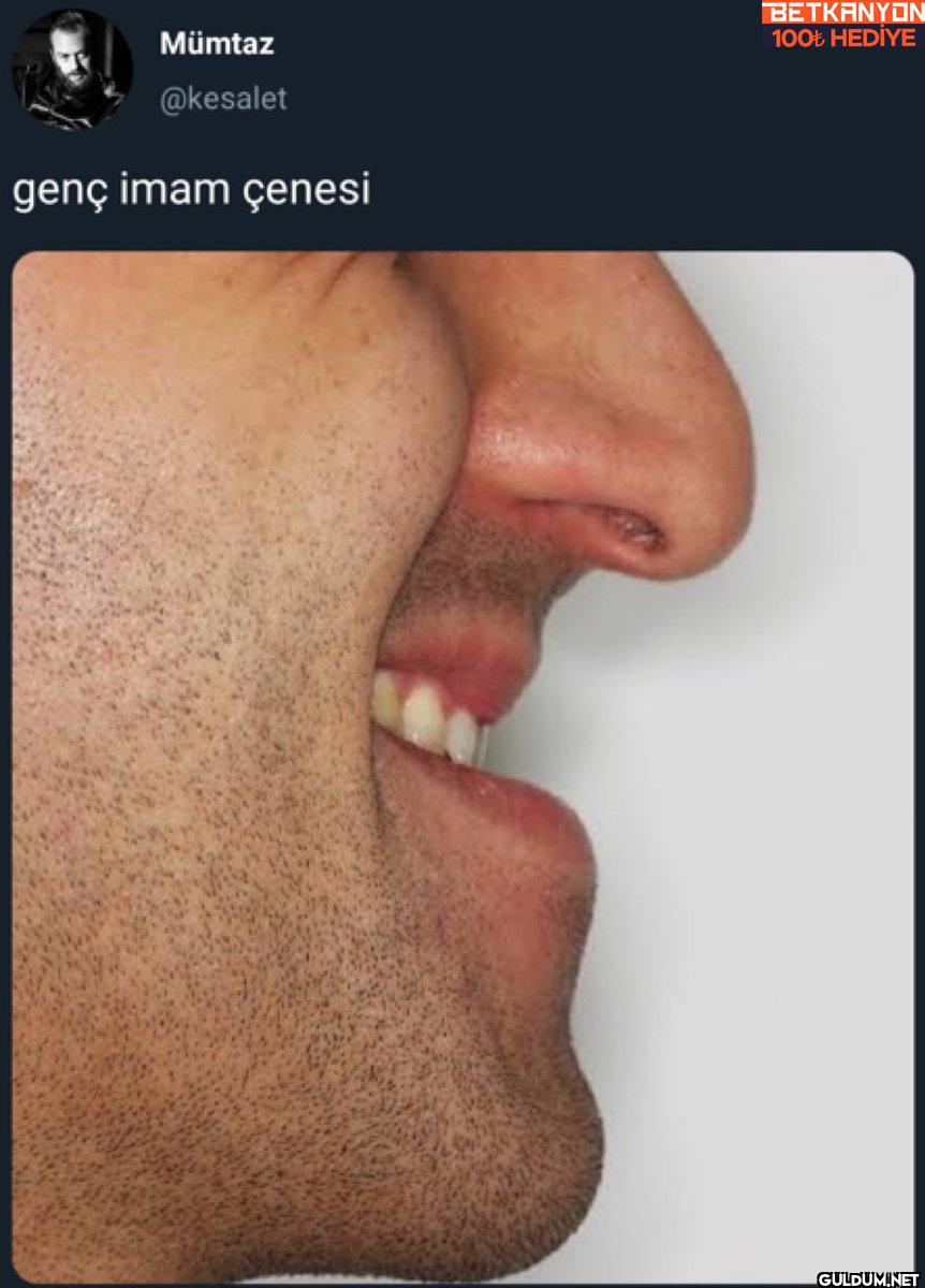 genç imam çenesi BETKANYON...