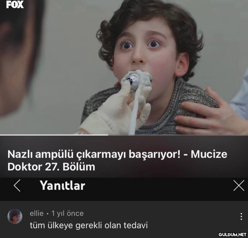 FOX Nazlı ampülü çıkarmayı...