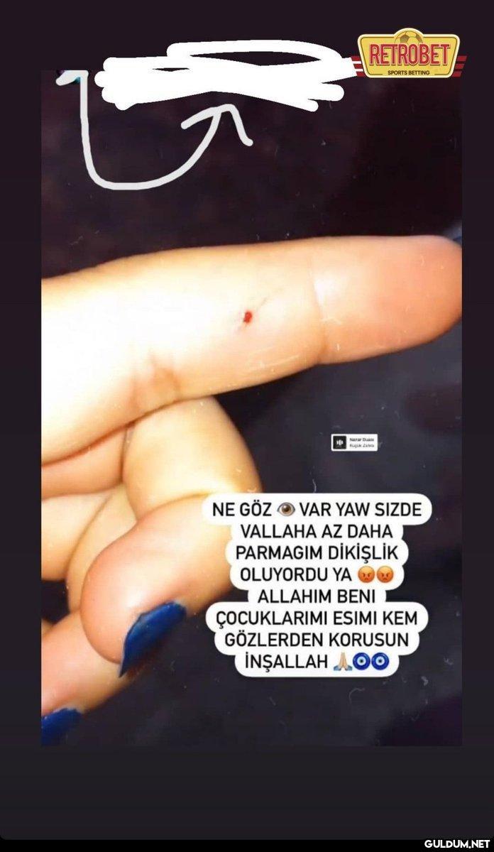 Allah korumuş seni ablam...