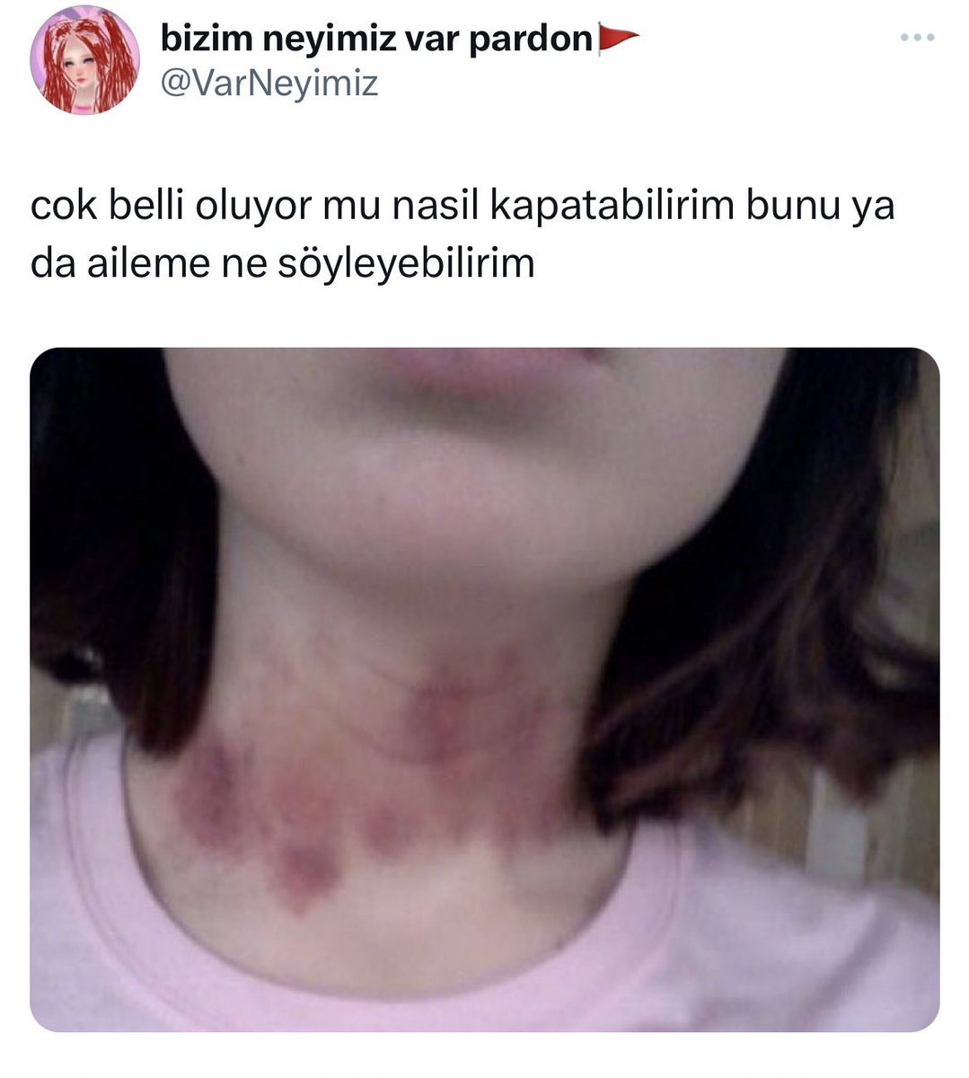 yok ya hiç belli olmuyor...