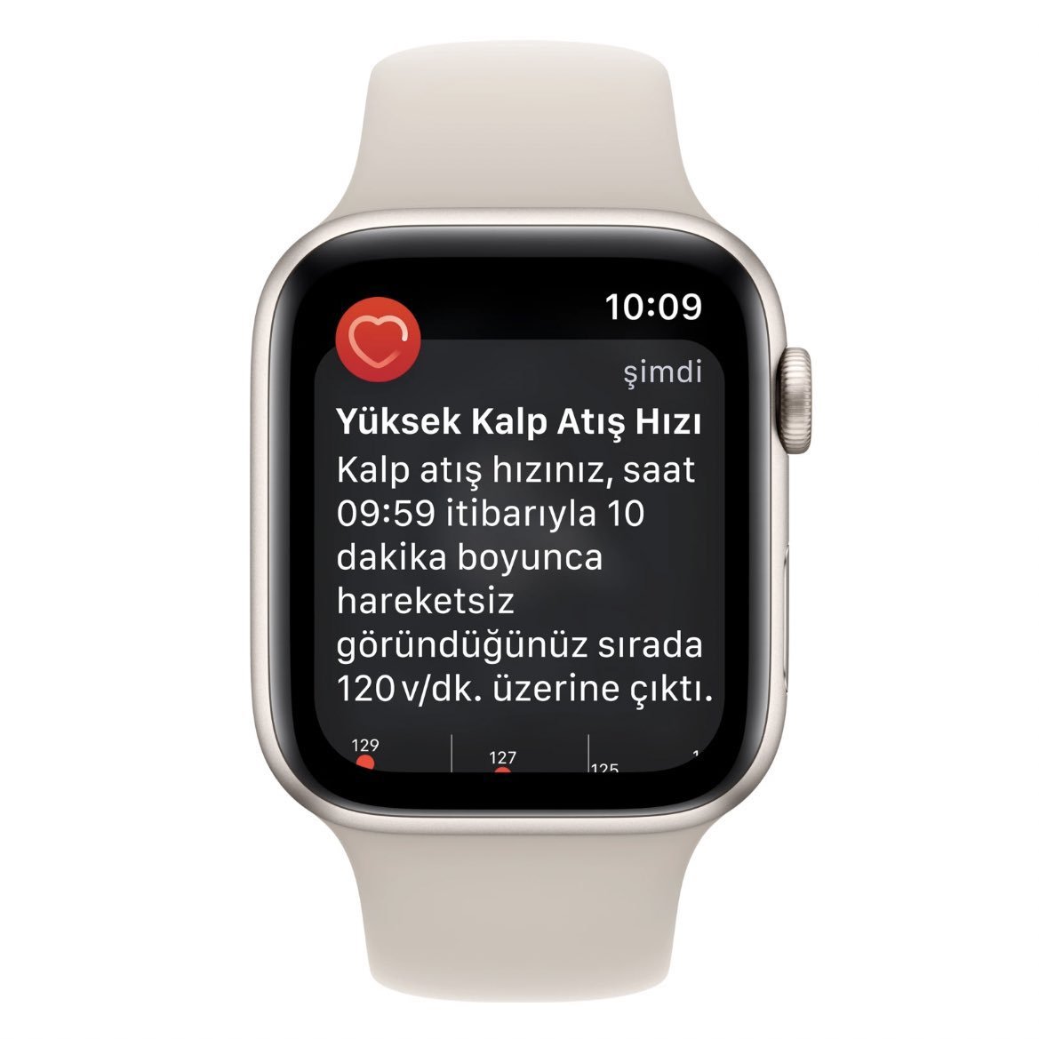 Apple Watch almayı düşünen...