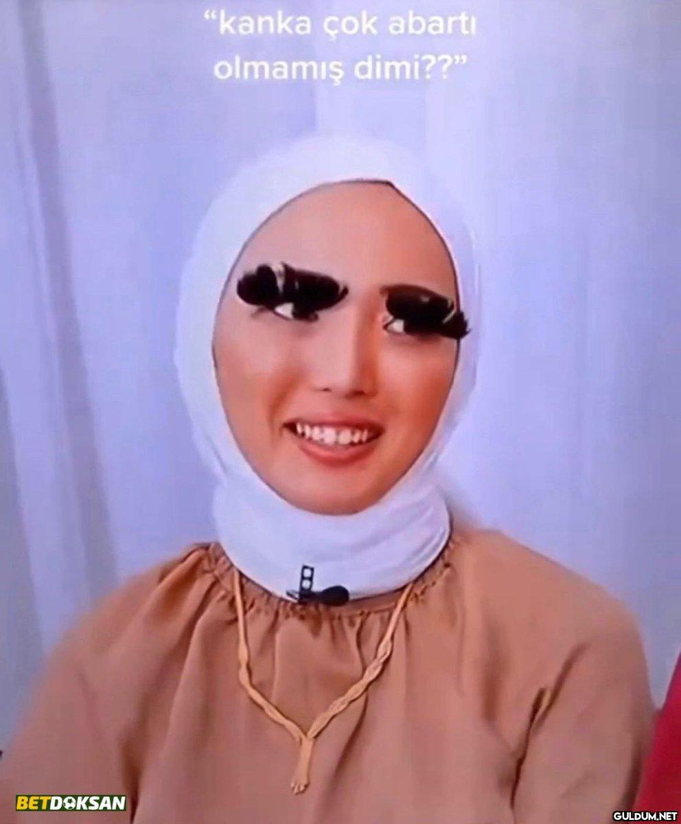 BETDOKSAN "kanka çok...