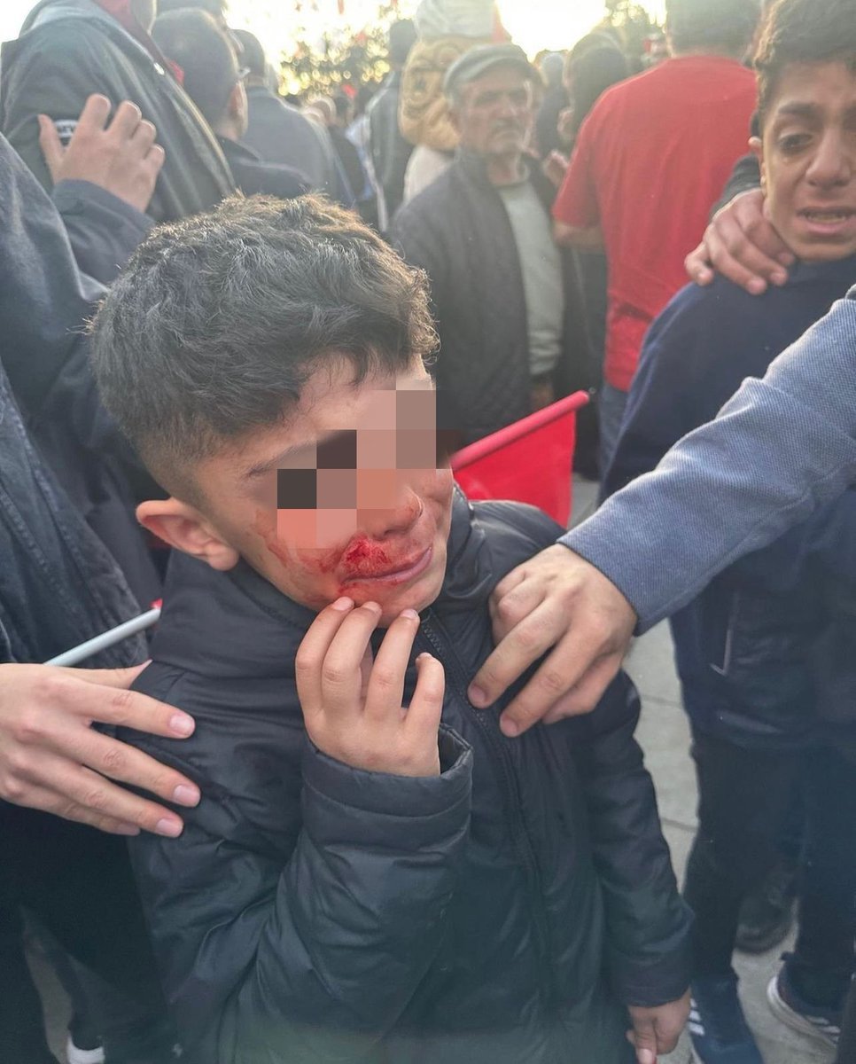 yazıklar olsun...