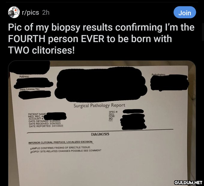 r/pics 2h Join Pic of my...