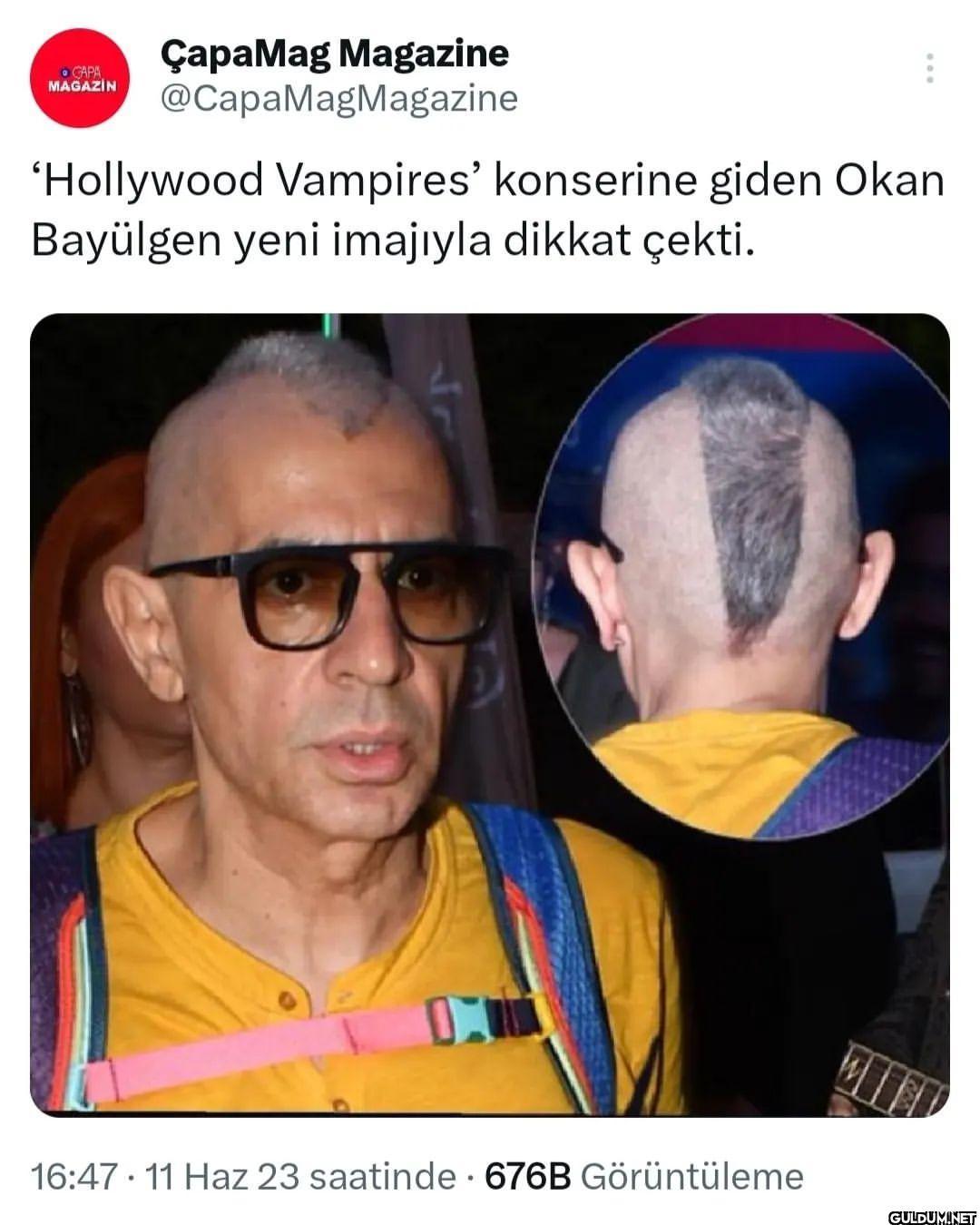 And the en kötü saç ödülü...