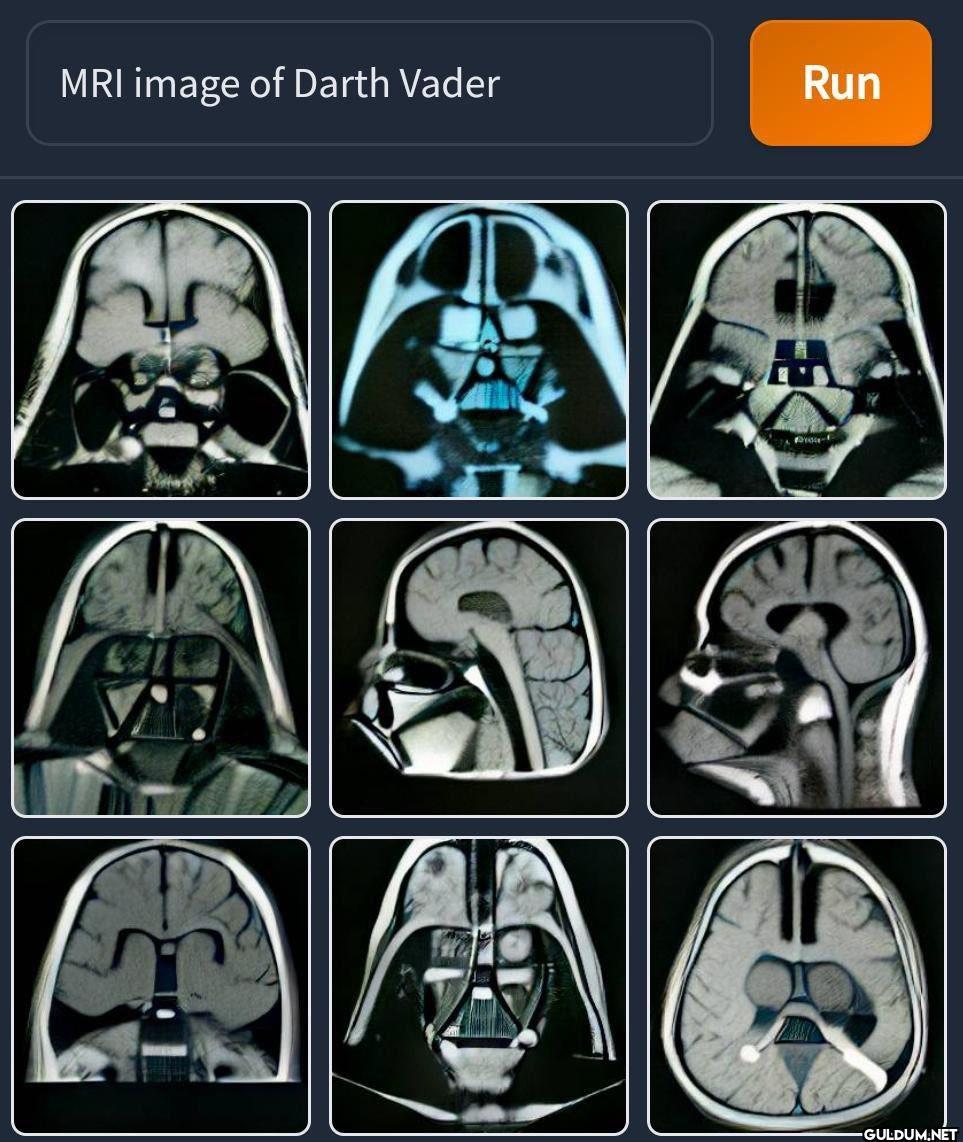 MRI image of Darth Vader...