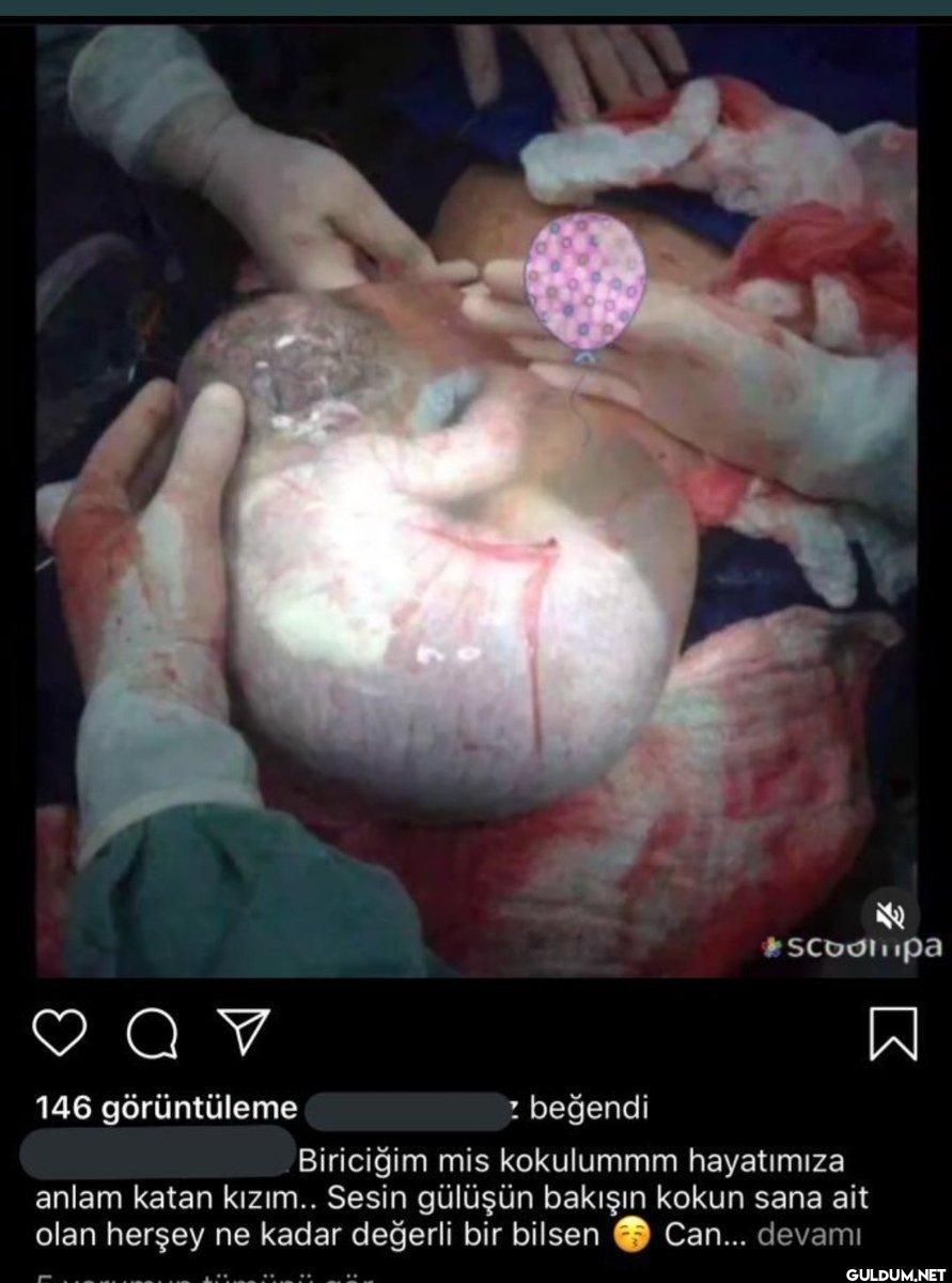 Bi müsade edin çocuk...