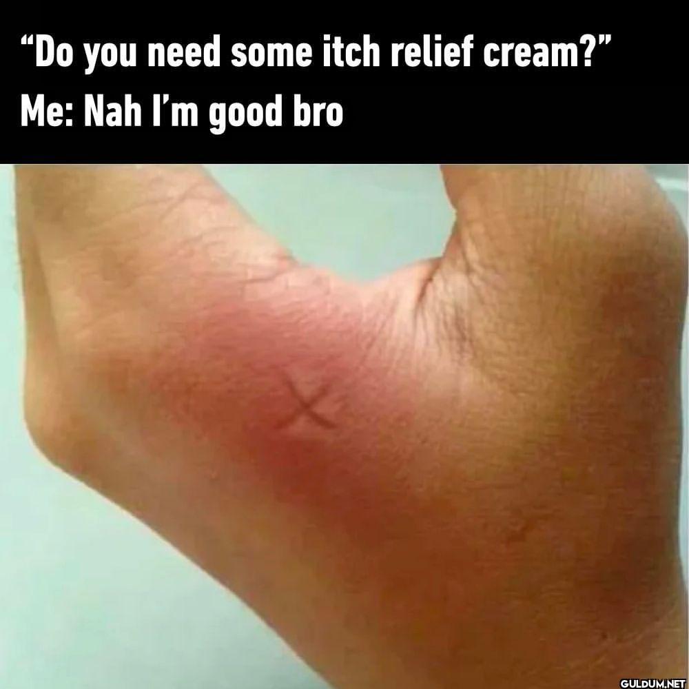 it works tho  - #itch...