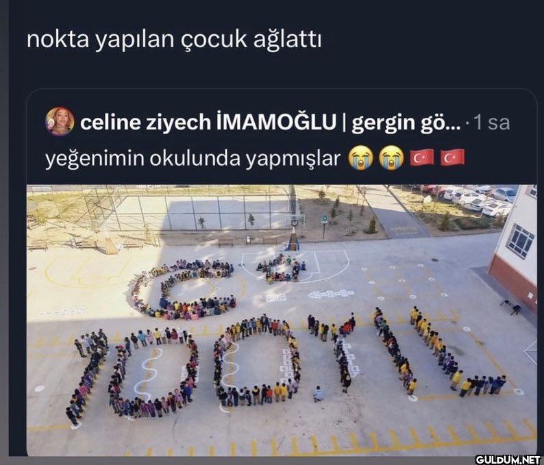 nokta yapılan çocuk...