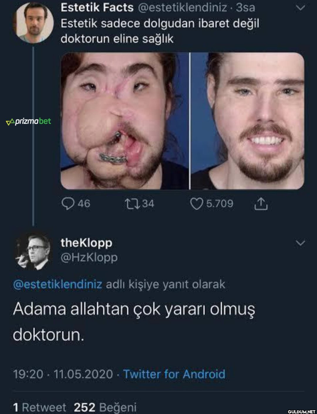 Aprizma bet Estetik Facts...