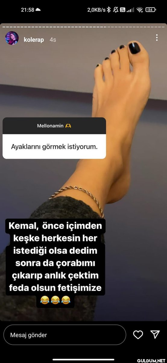 kolera ayak fotoğrafı...