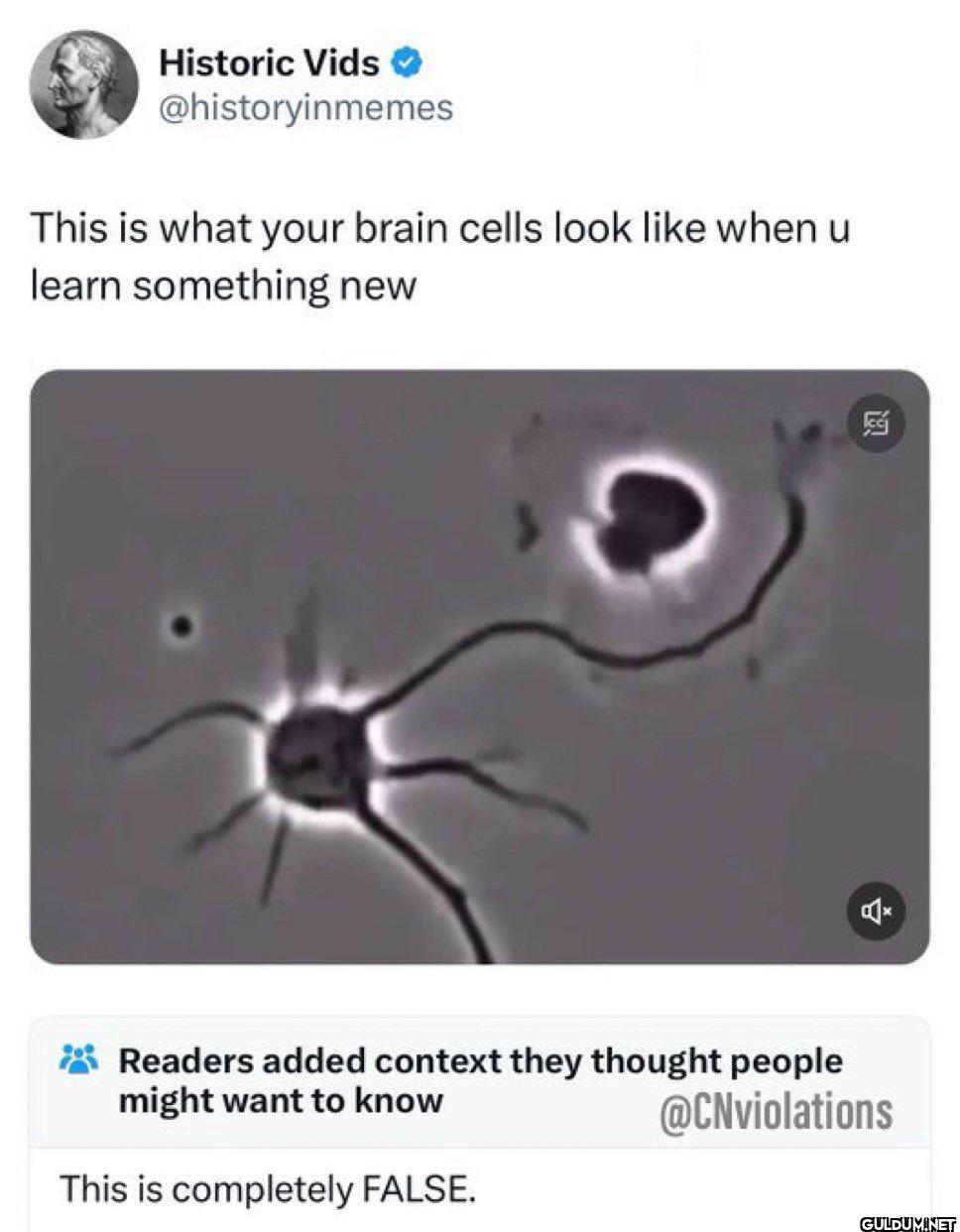 This is what your brain...