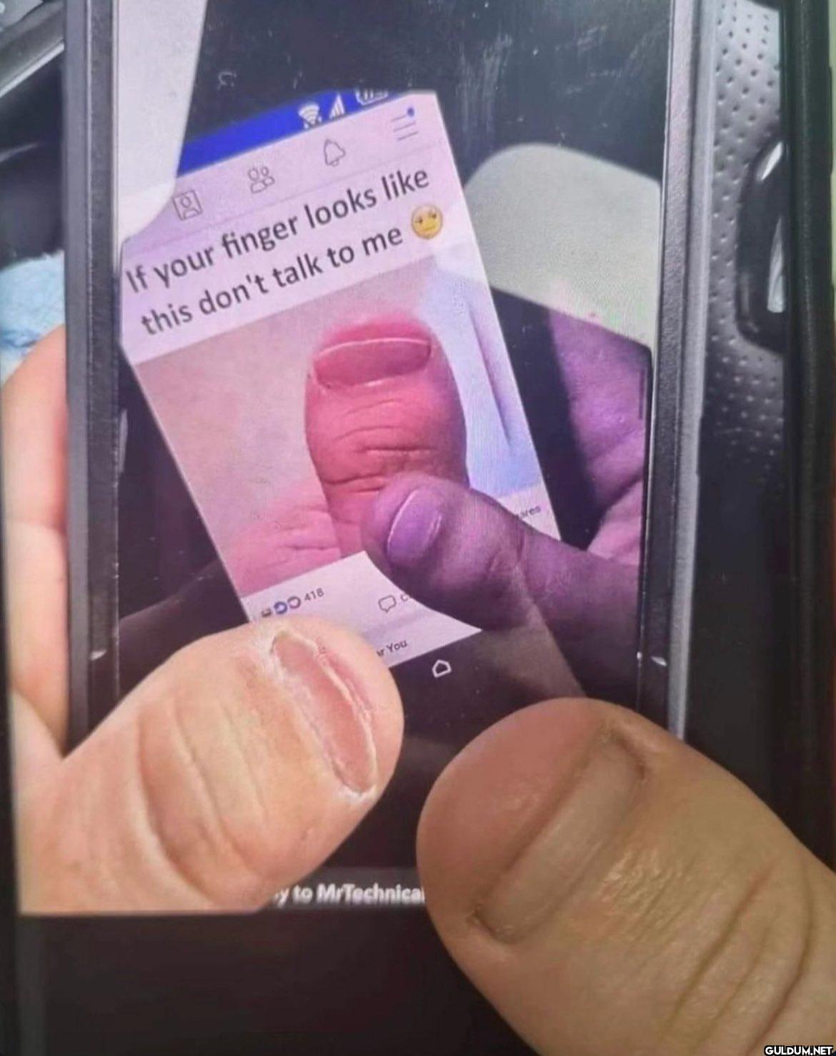P D If your finger looks...