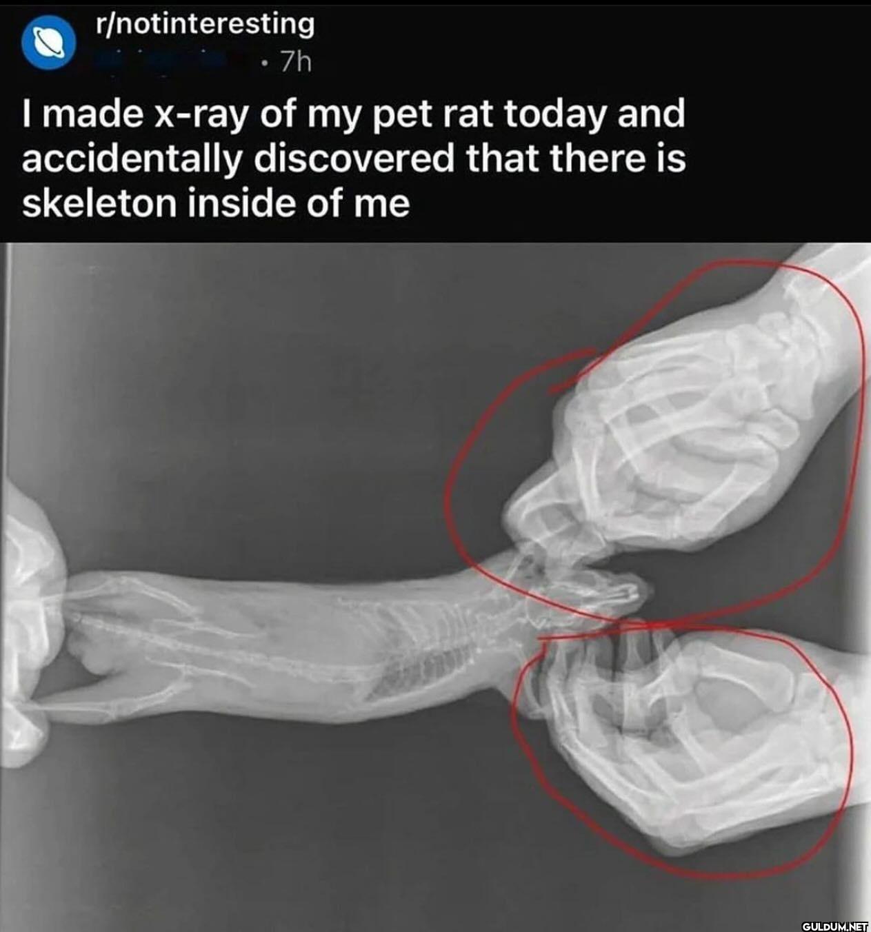 . 7h I made x-ray of my...