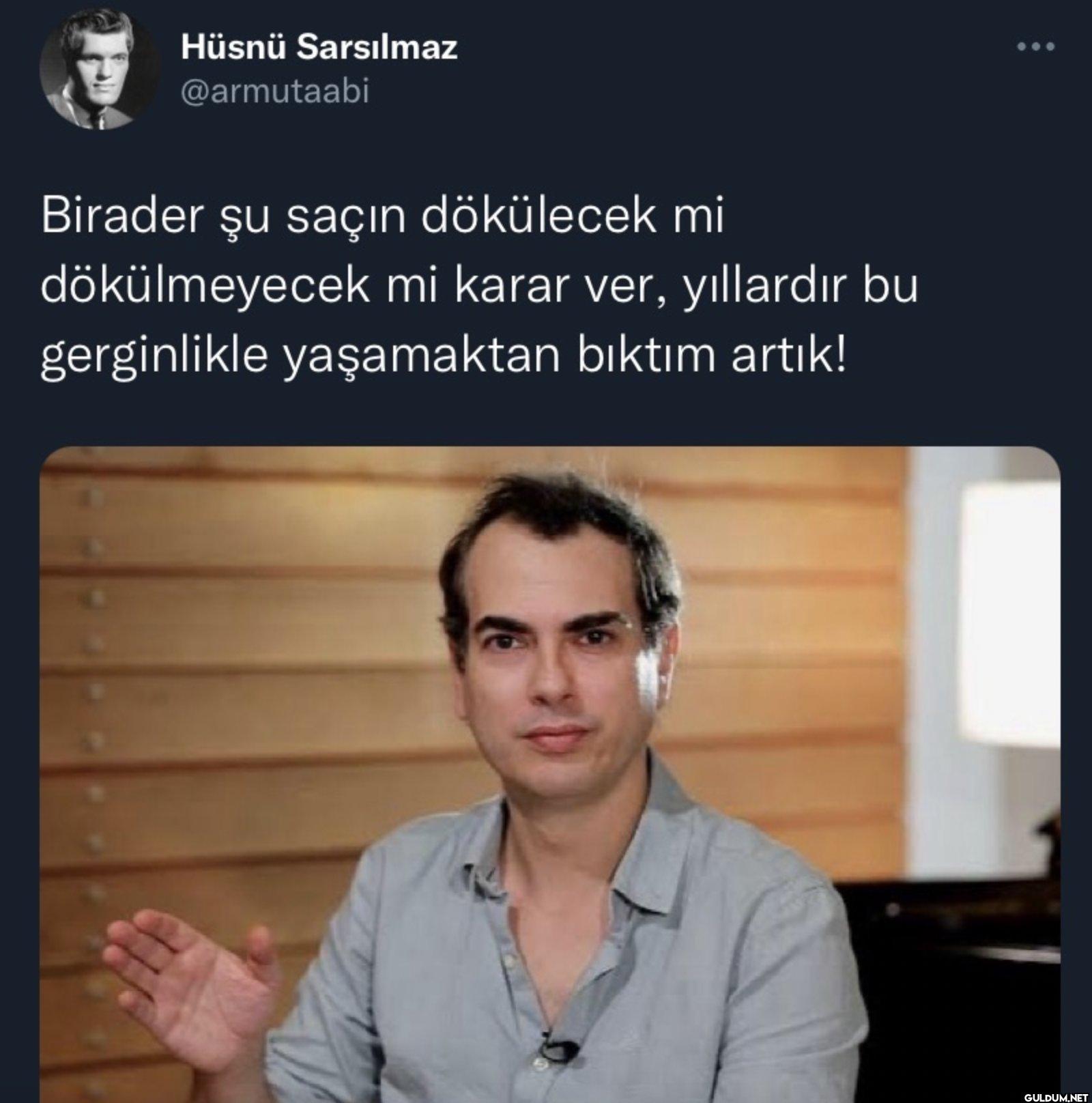 Birader şu saçın dökülecek...
