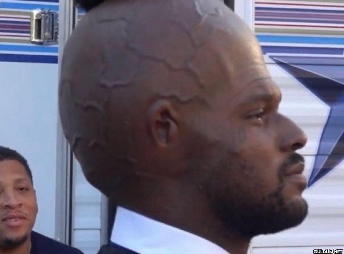 when I say my head...