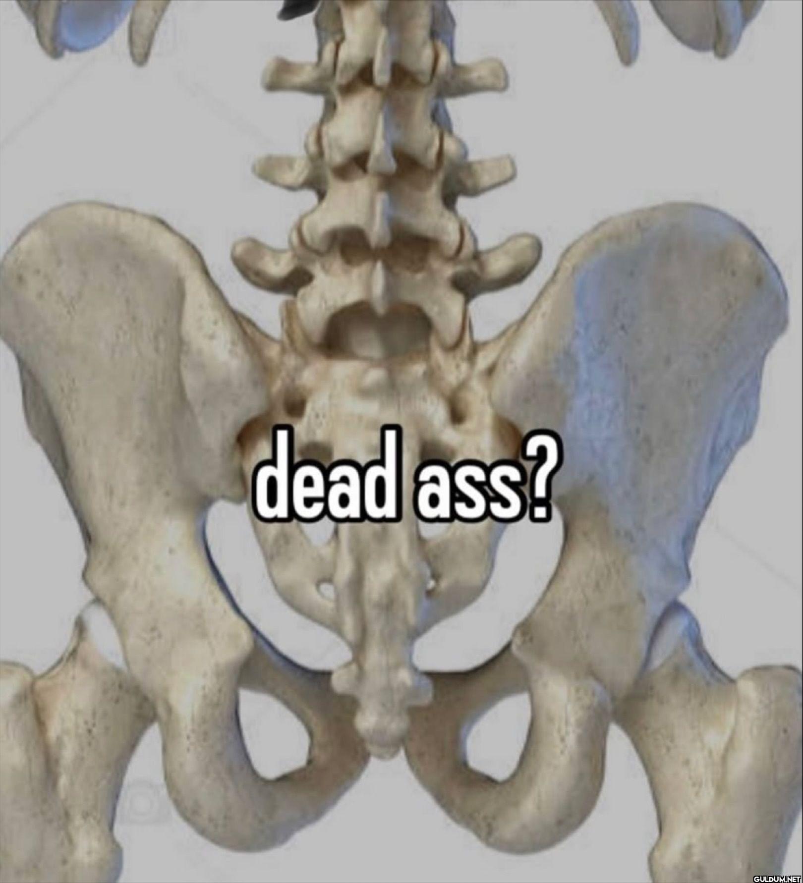 dead ass?