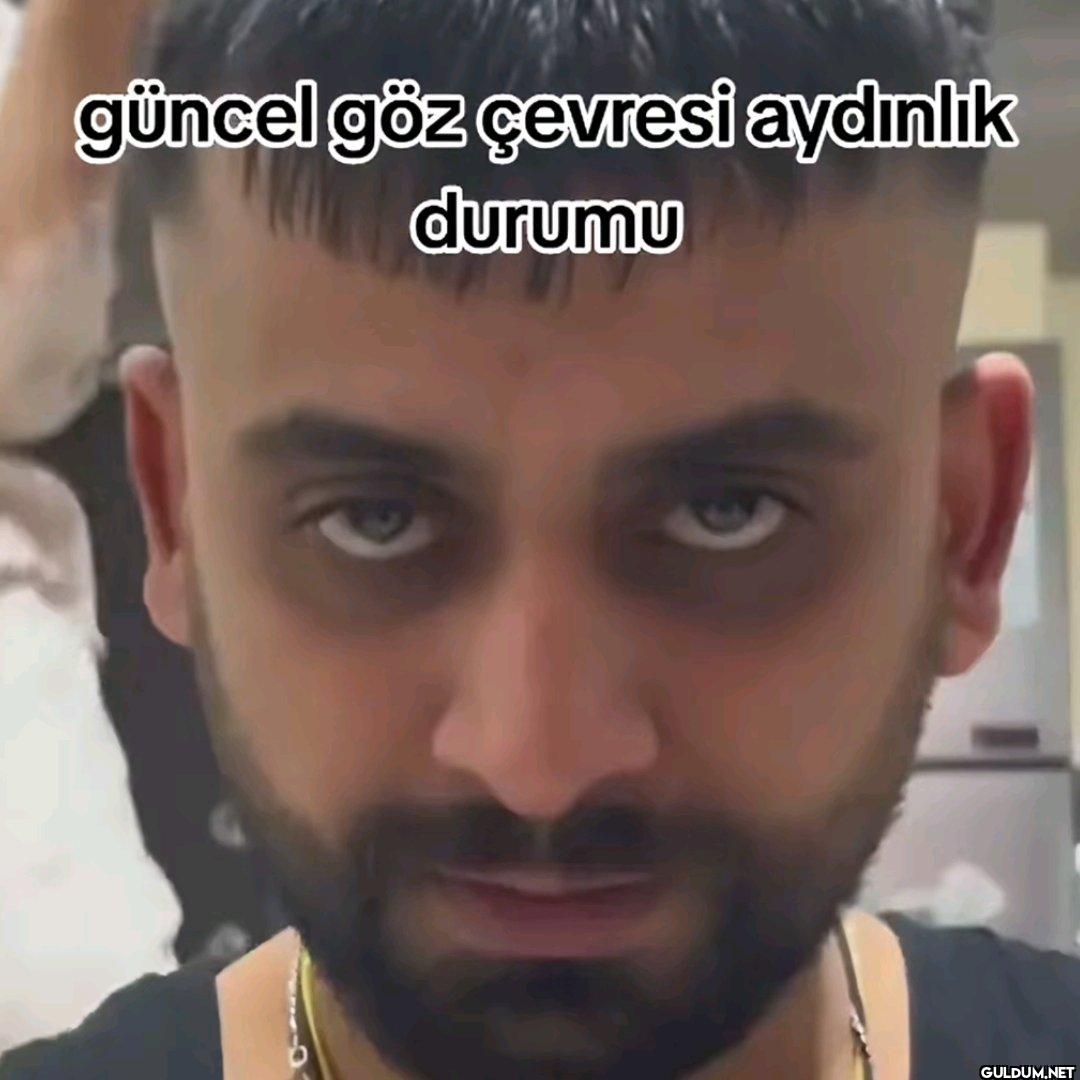 güncel göz çevresi aydınlık durumu