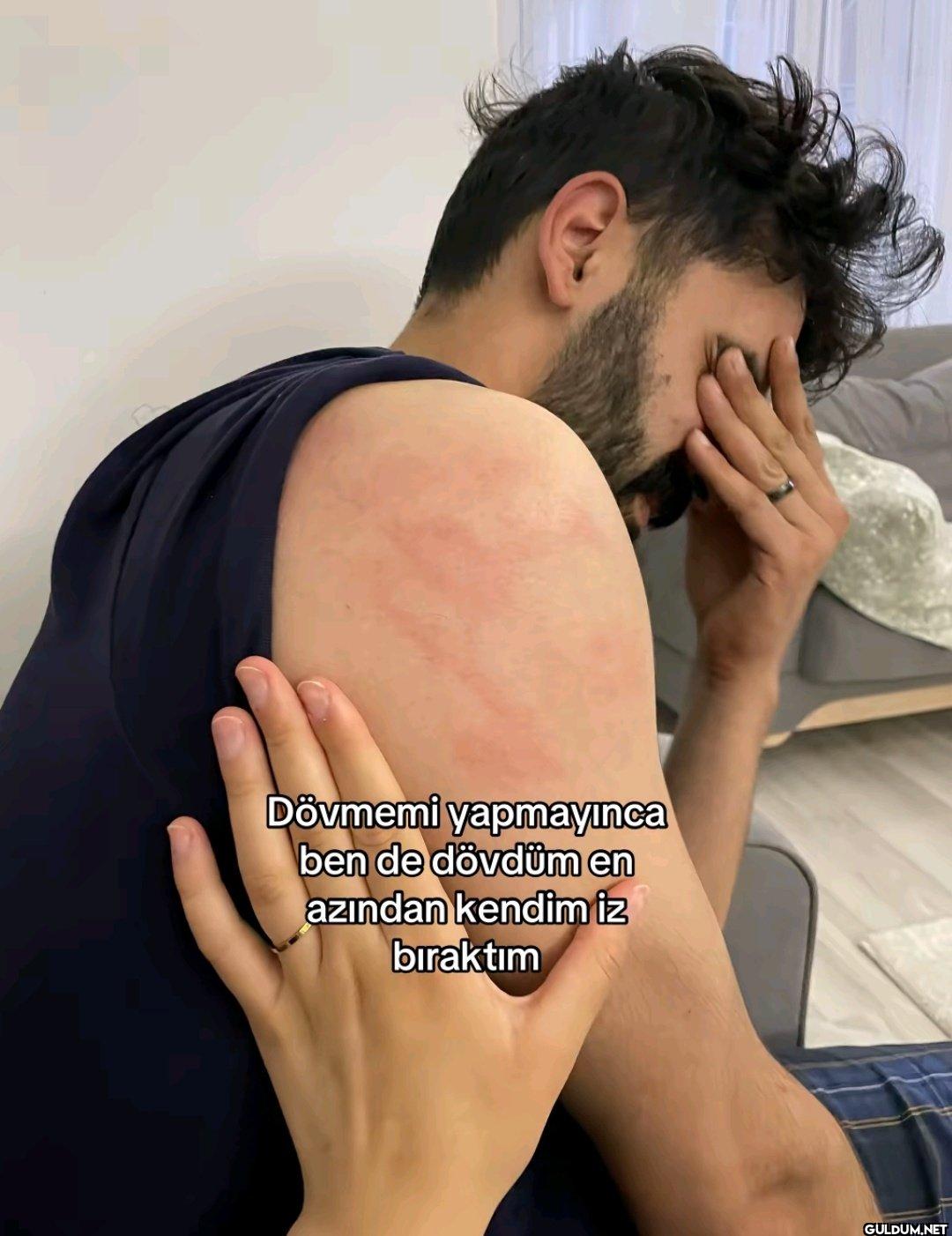 Dövmemi yapmayınca ben de...