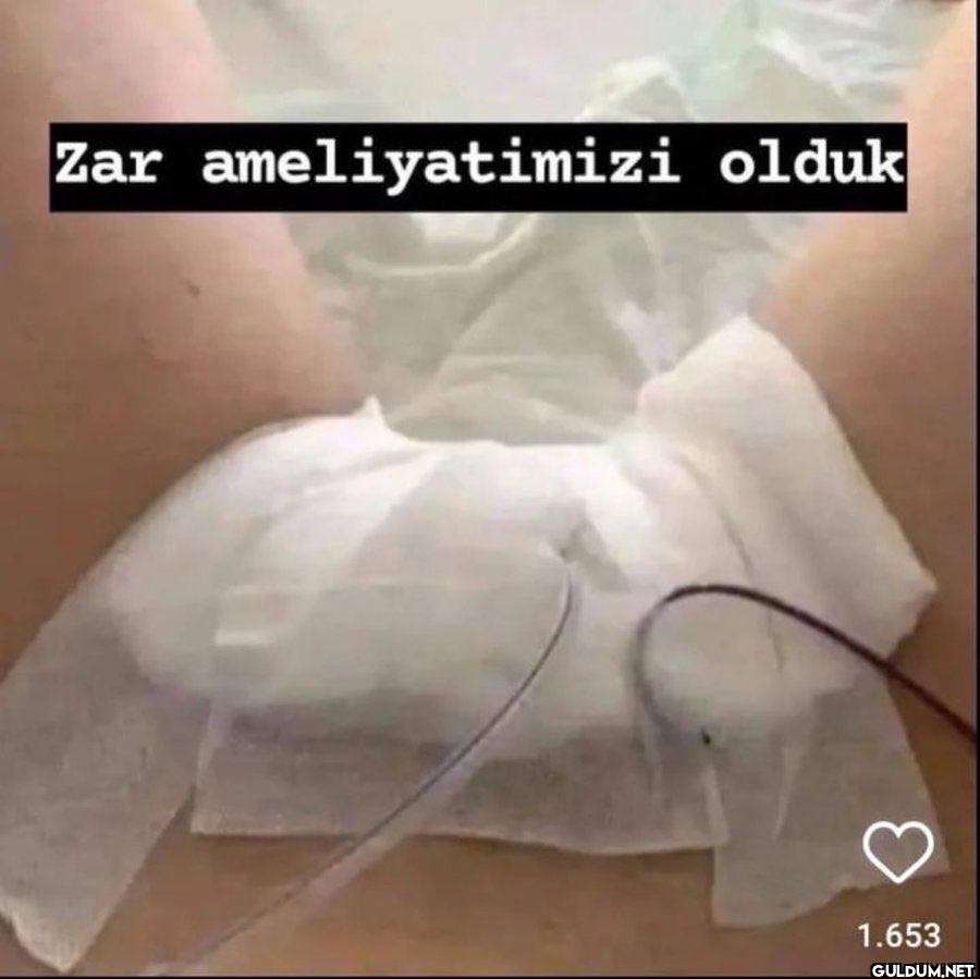 Zar ameliyatimizi olduk 1.653