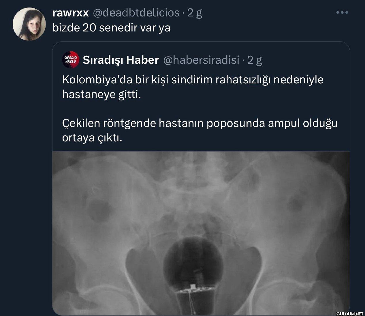2 g bizde 20 senedir var...