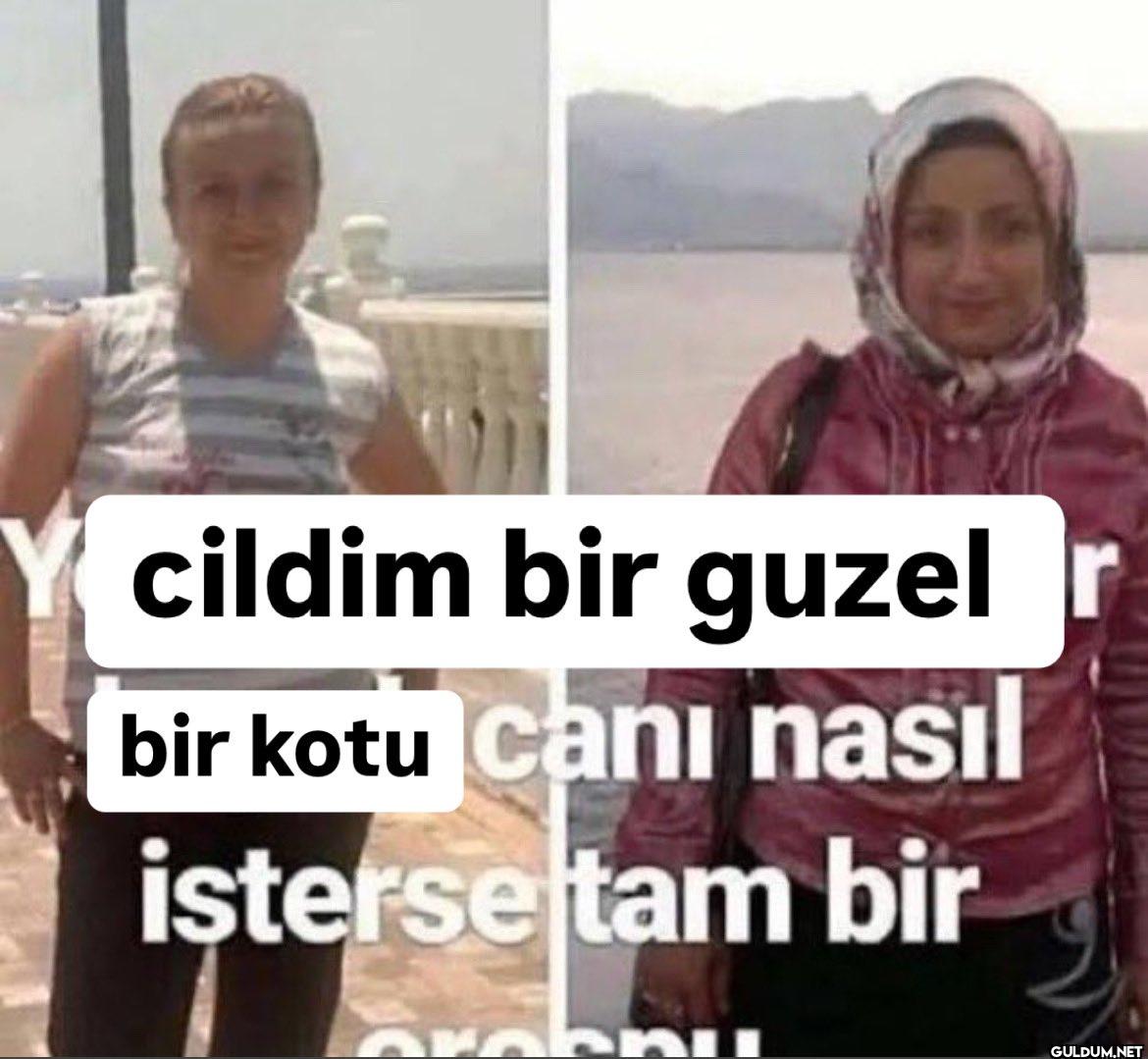 cildim bir guzel bir kotu...
