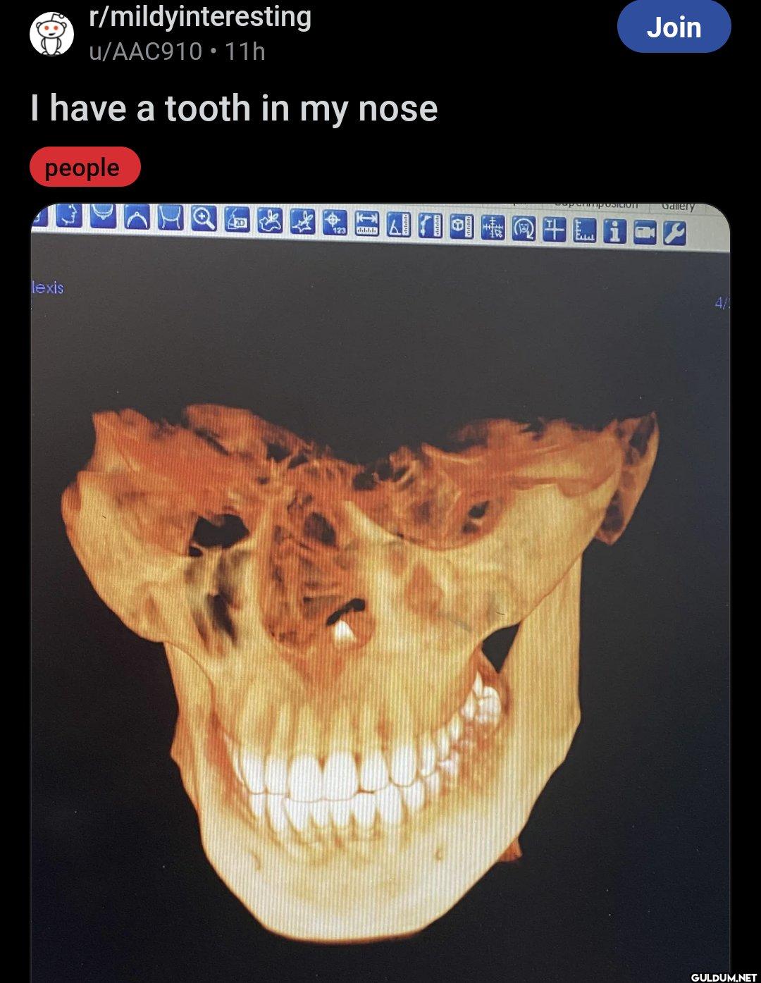 r/mildyinteresting...