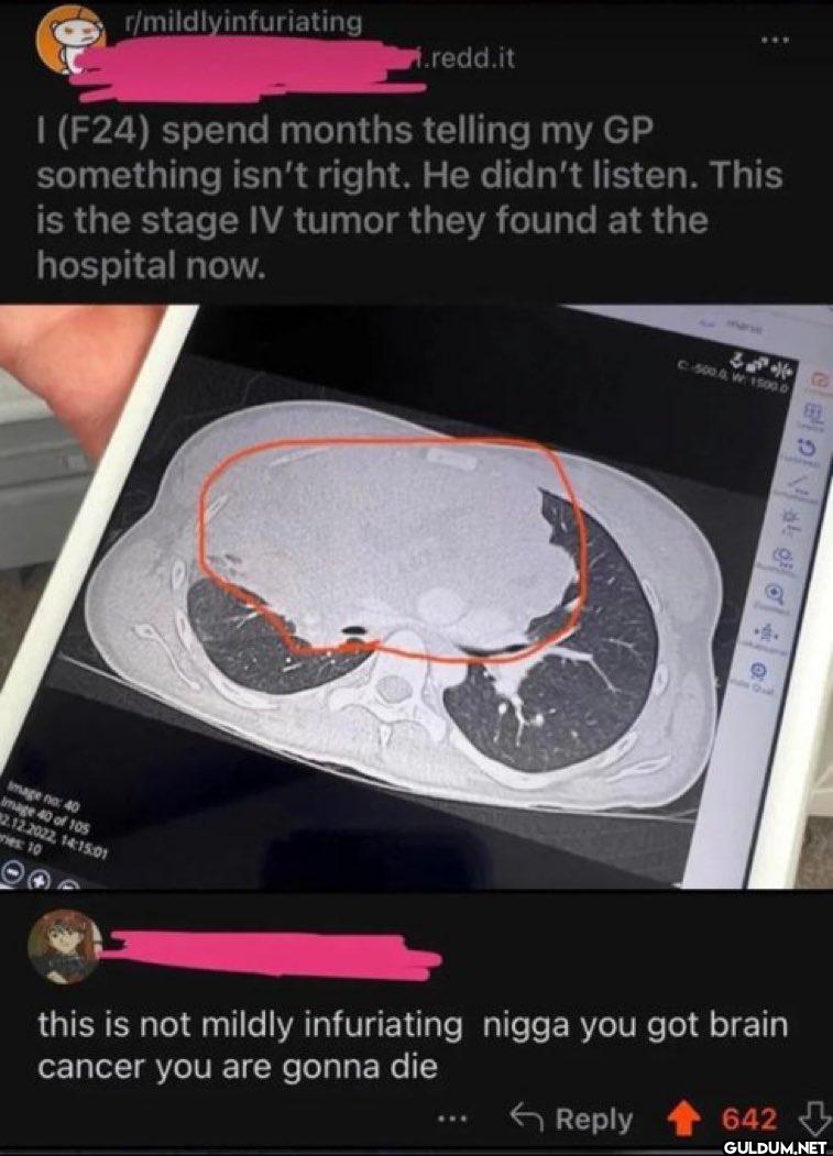 r/mildlyinfuriating...