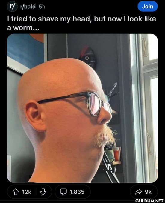 ㅤ    r/r/bald 5h Join I...