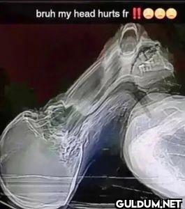 bruh my head hurts fr 이런