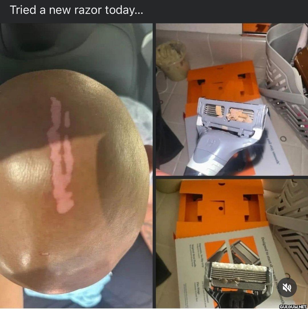Bro peeled himself   ...