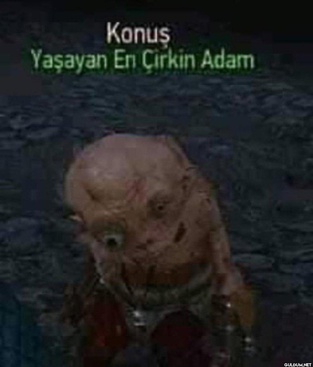 79-) yaşayan en çirkin...