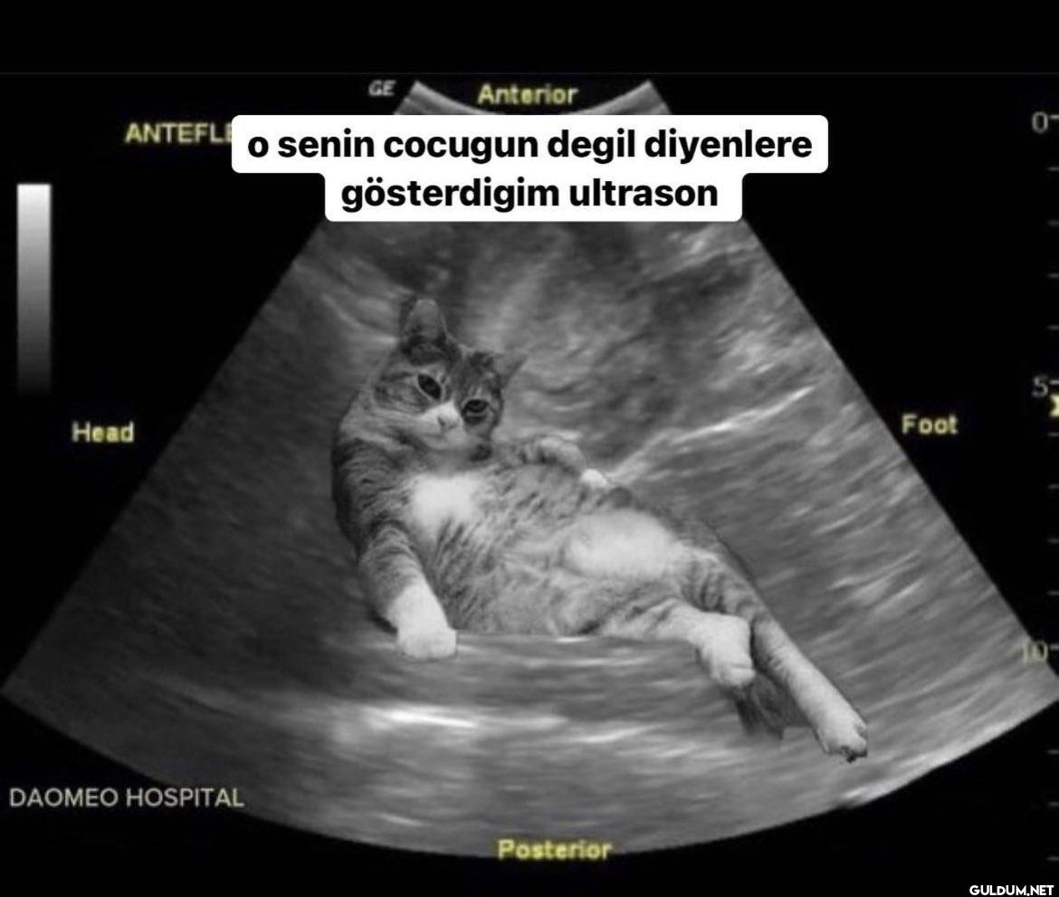 Anterior ANTEFLE o senin...