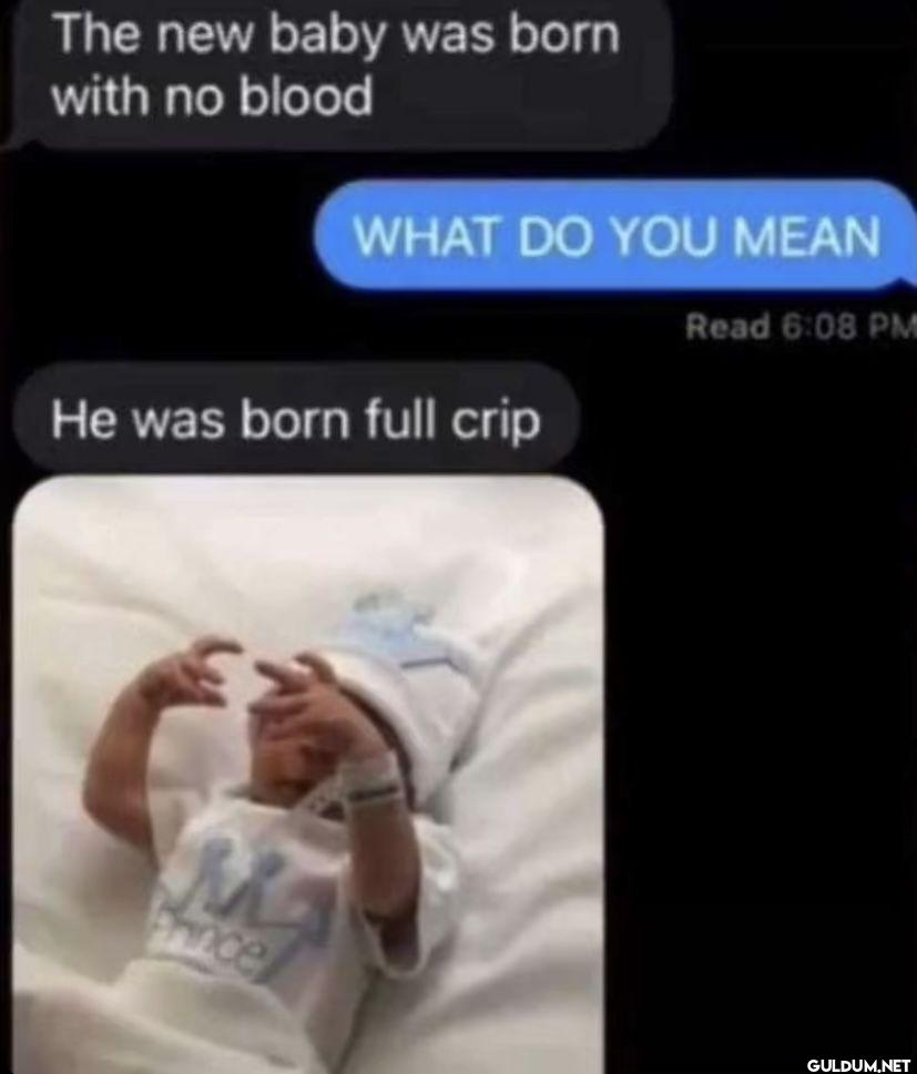 The new baby was born with...