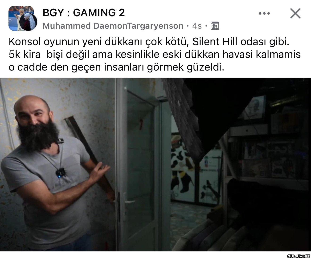 bu adam ünü artarken nasıl...