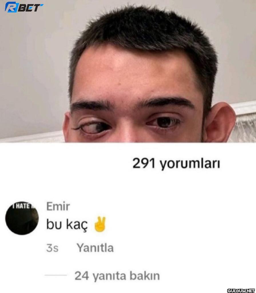 R BET 291 yorumları HATE...