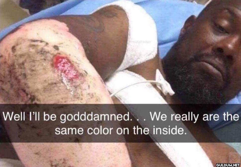 bro just ended racism   ...