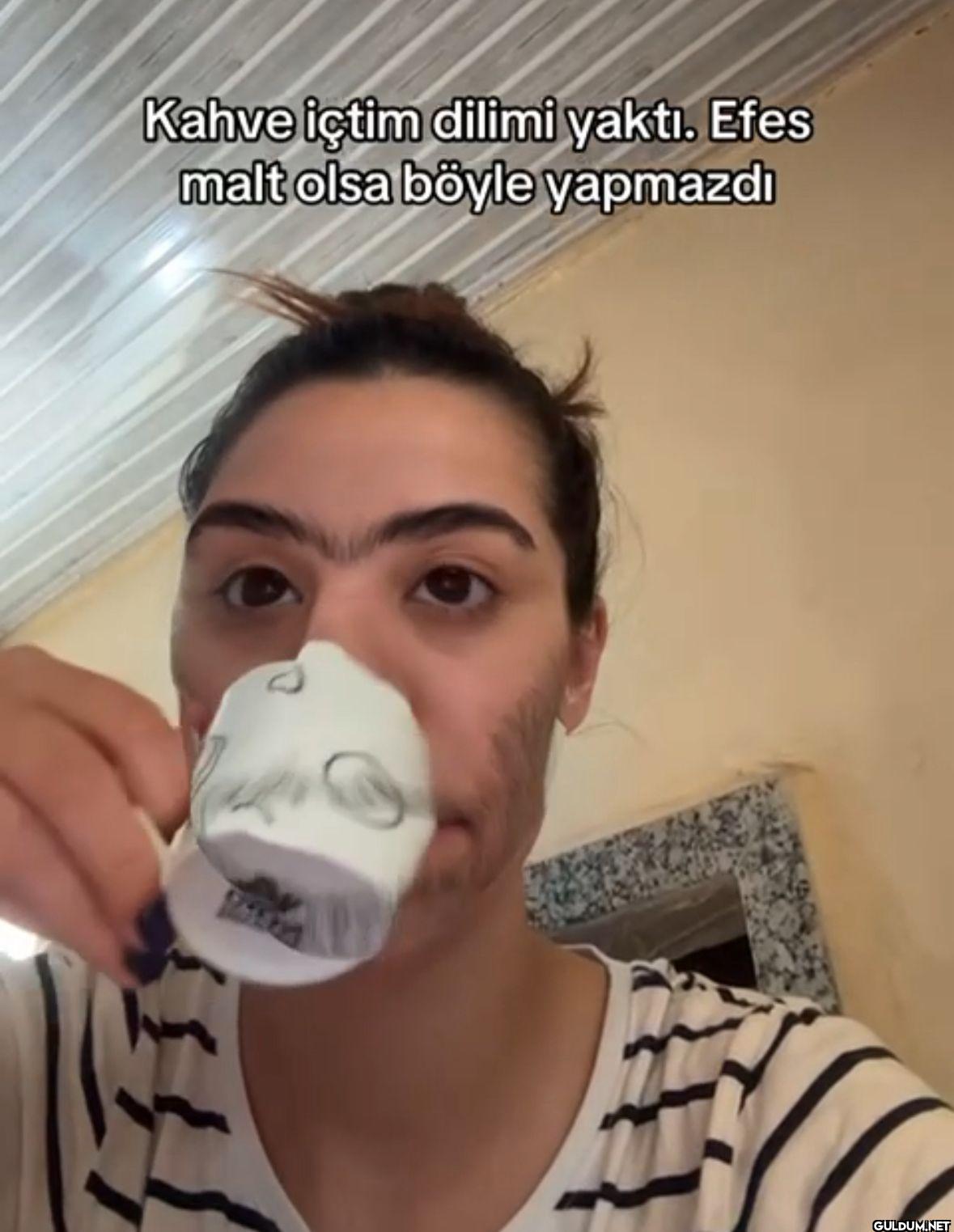 Kahve içtim dilimi yaktı....