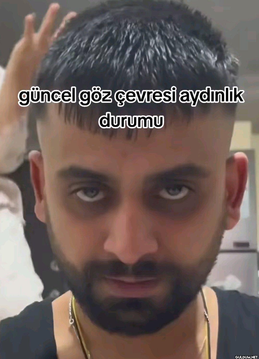 güncel göz çevresi aydınlık durumu