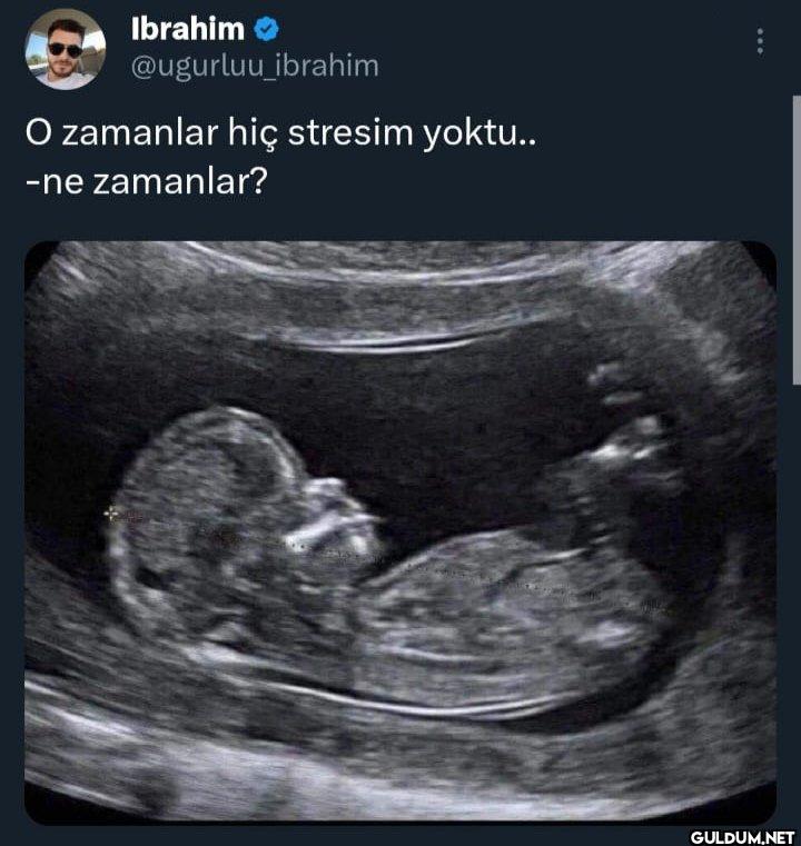 O zamanlar hiç stresim...