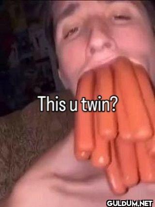 This u twin?