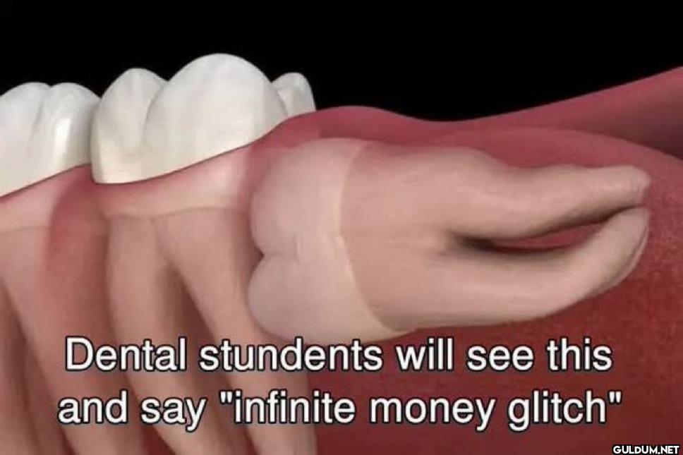 Dental stundents will see...