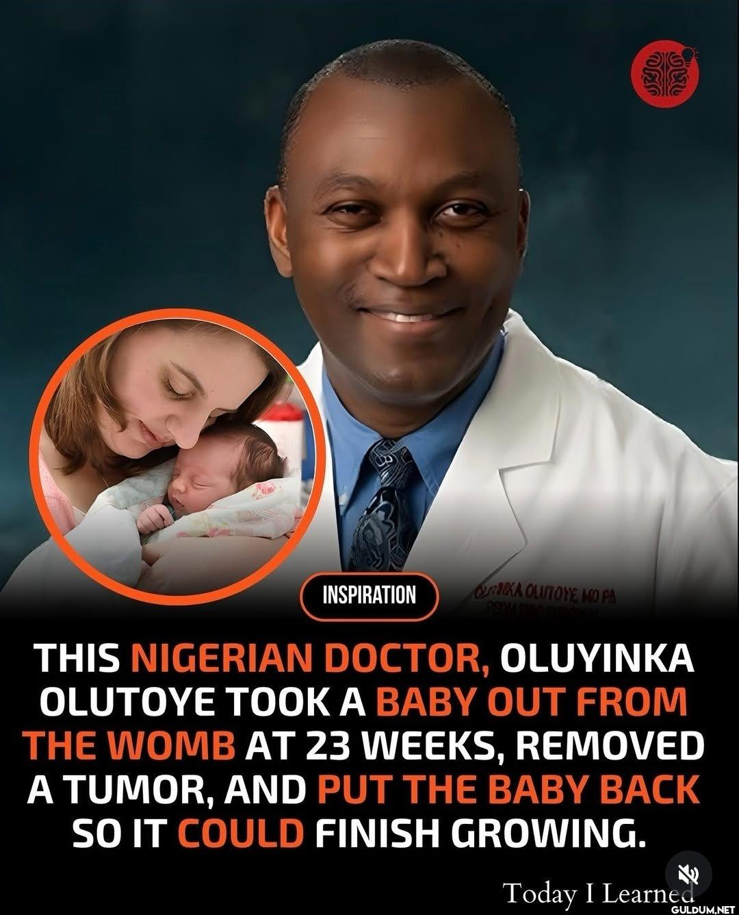 That is truly a miracle 👏 ...