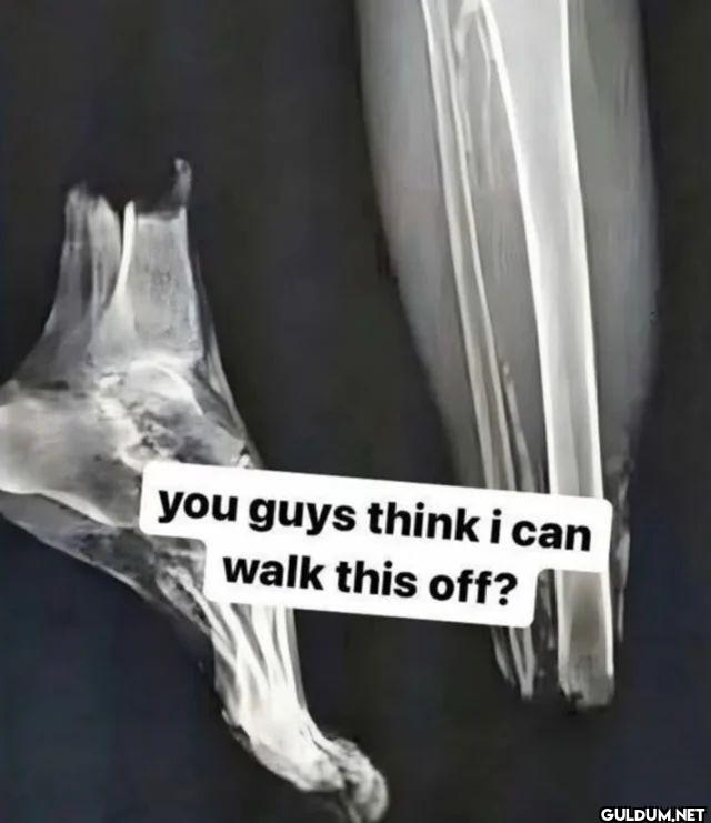 you guys think i can walk this off?
