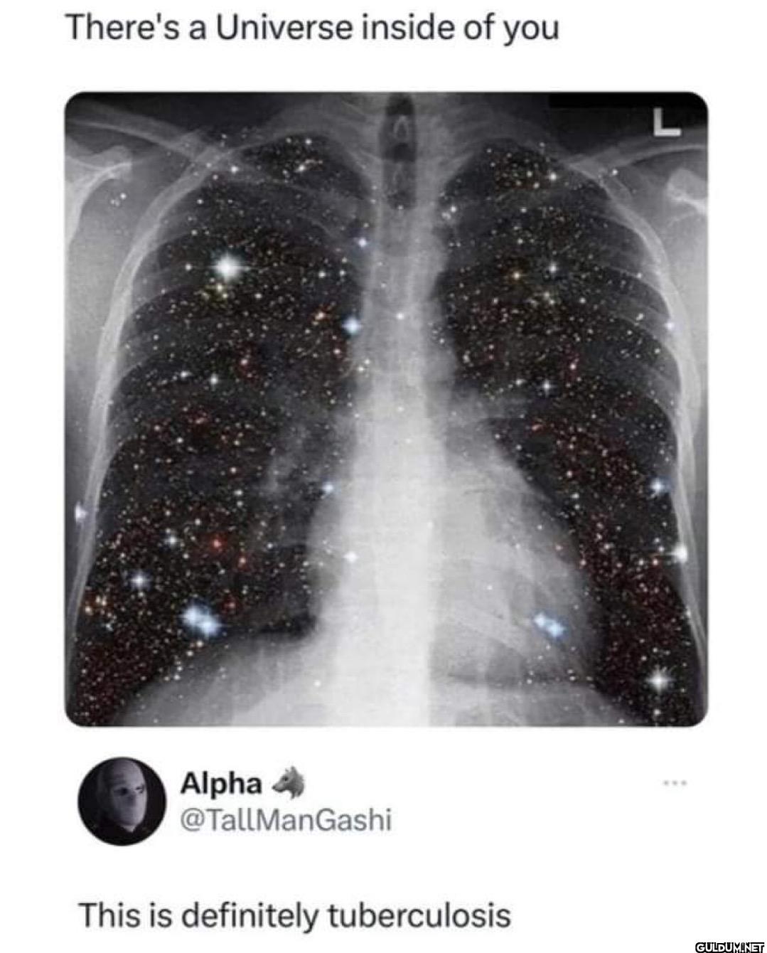 There's a Universe inside...
