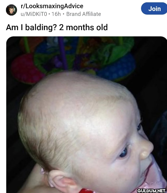 r/LooksmaxingAdvice...