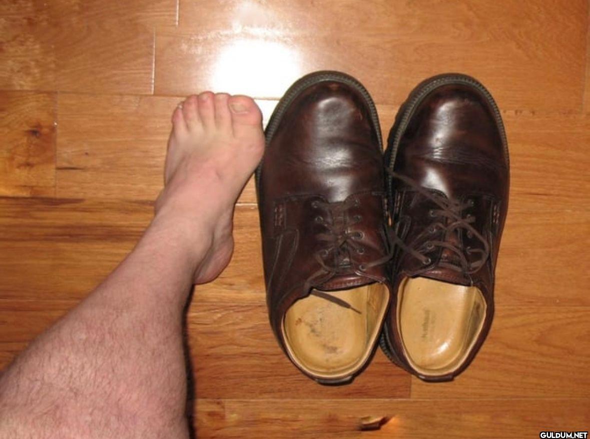This man’s feet stopped...